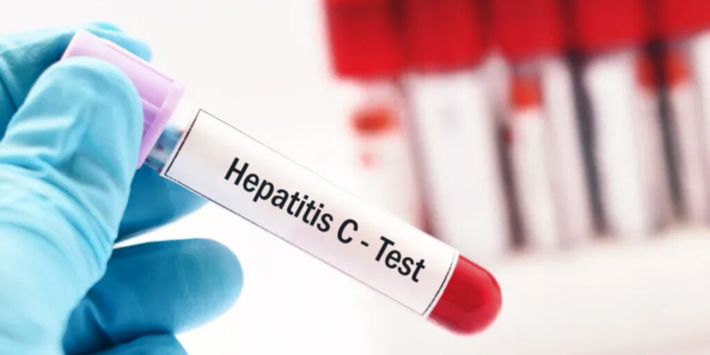 NHS Urges GPs & Patients to Identify Victims of Contaminated Blood Scandal