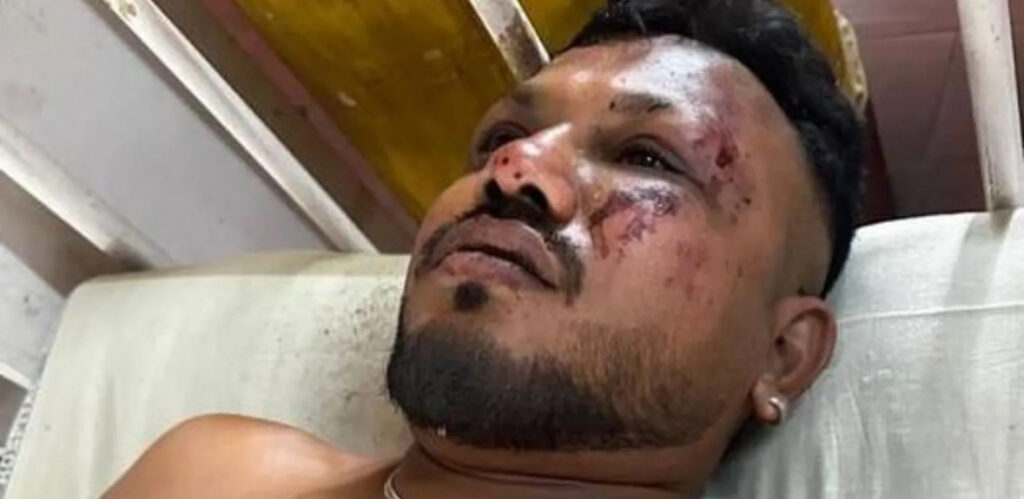 UK Man Survives Deadly Air India Plane Crash