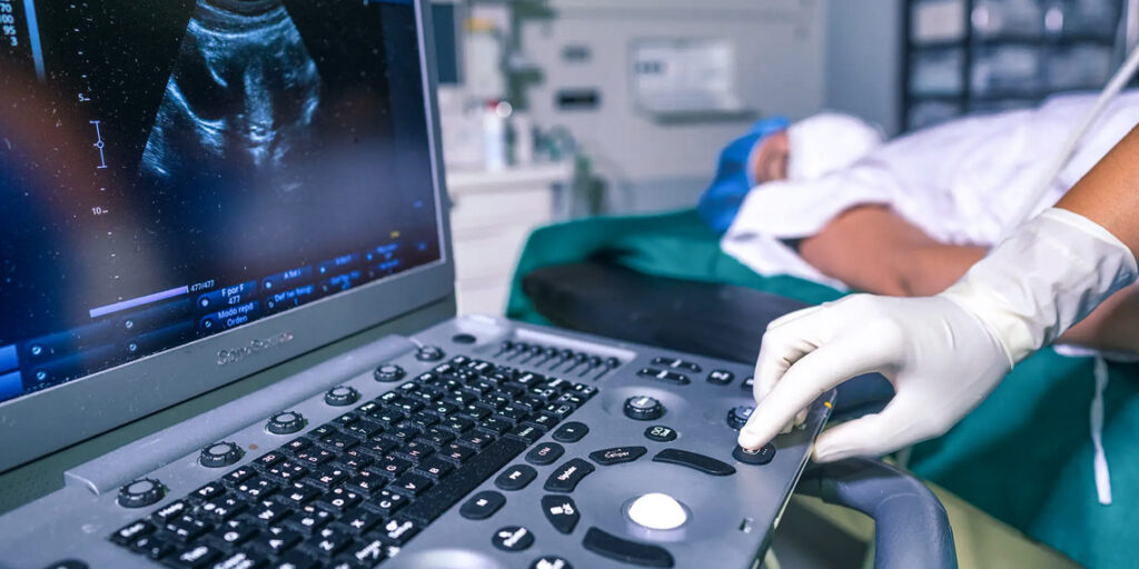 UK Women Face Longer Waits for Ovarian Cancer Care