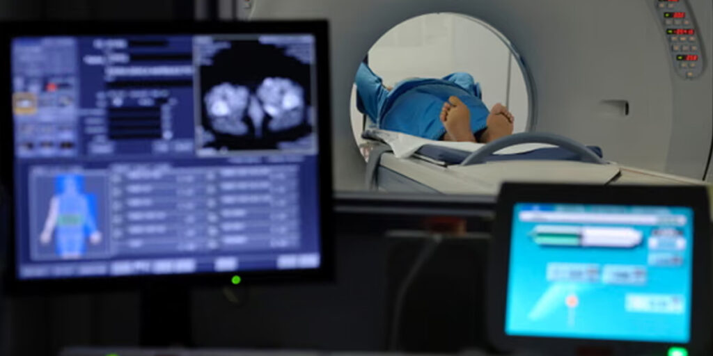 England Faces Severe NHS Diagnostic Backlog